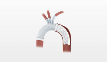 Cardiovascular & Endografting